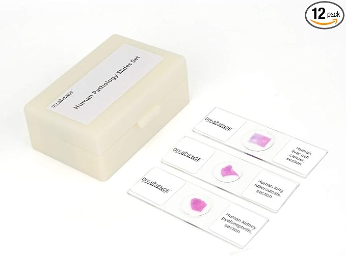 Prepared Human Pathology Microscope Slide Set, 12pcs Research-Quality Prepared Tissue Microscope Slides of Human Diseases (Human Pathology)