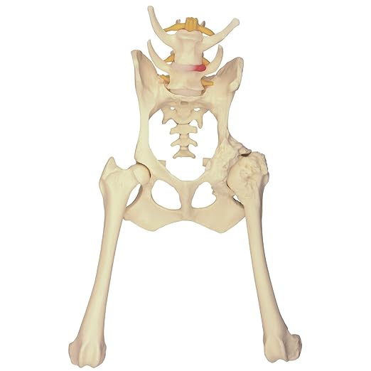 GPI Anatomicals - Canine Pelvis Model, Normal and Osteoarthritic Hip Joint Bones for Anatomy, Physiology Education, Anatomy Model for Veterinarian’s Offices and Classrooms, Medical Learning Resources