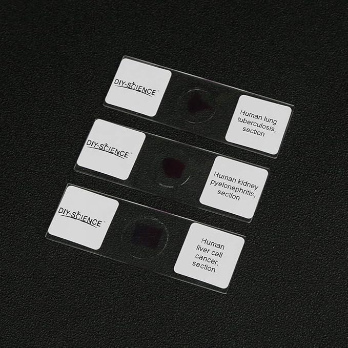 Prepared Human Pathology Microscope Slide Set, 12pcs Research-Quality Prepared Tissue Microscope Slides of Human Diseases (Human Pathology)